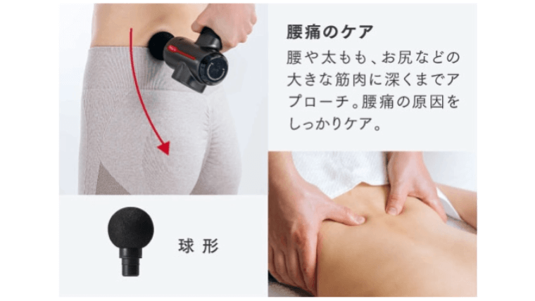 球形